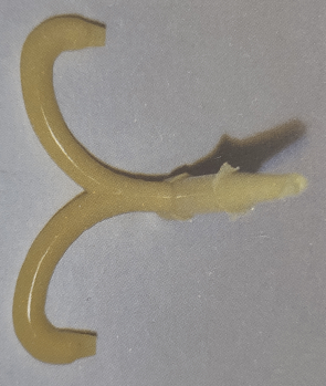 注塑產(chǎn)品缺陷料頭附近有暗區的理解